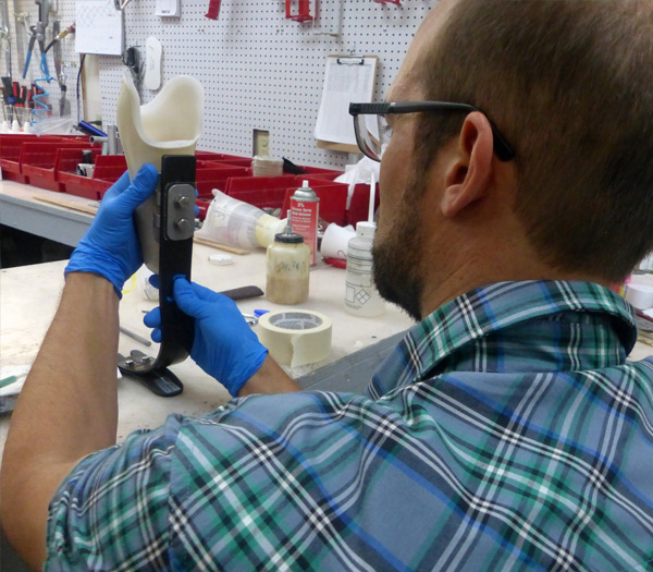 Pediatric Prosthetics
